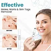 Non-Invasive Mole and Wart Removal Laser Pen