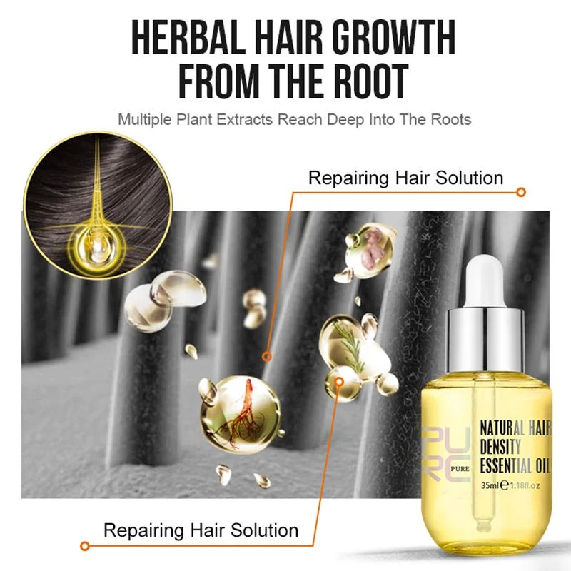 PURC&trade; Hair Growth Essential Oil - Reclaim Your Luscious Locks!