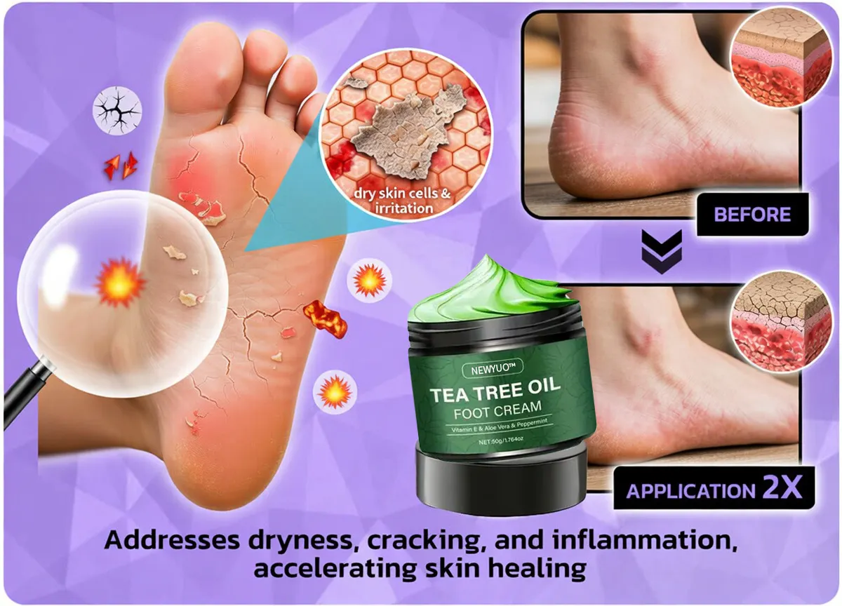 🎁 NEWYUO™ Limited-Time Offer 🎁 - Don't miss out!Tea Tree Oil Foot Cream (Repairs Dry Cracked Heels, Soothes Tired Feet, Eliminates Odor & Restores Soft Skin)