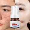 🔥Vitamin C Whitening Freckles Face Cream Remove Melasma Dark Spots Lighten Melanin