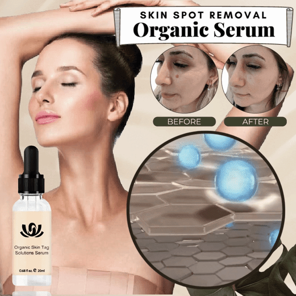 💥50% OFF-Experts Recommend Product - 2022 New  Organic Premium Skin Repair Serum