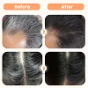 🔥🥰Teinture capillaire &agrave; base d'extraits v&eacute;g&eacute;taux pour cheveux gris