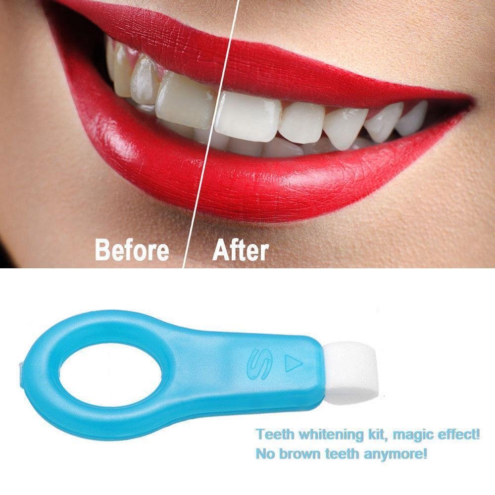 Non peroxide teeth whitening strips reviews