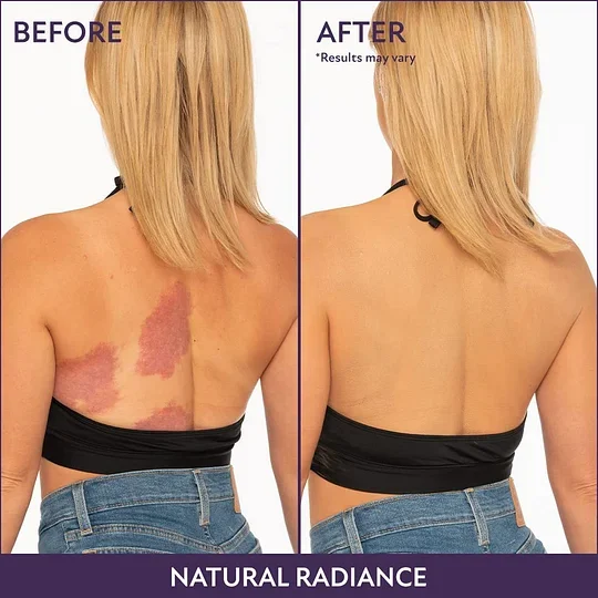 🎉Last Day 49% Off🎁 - All Over Complexion Perfector