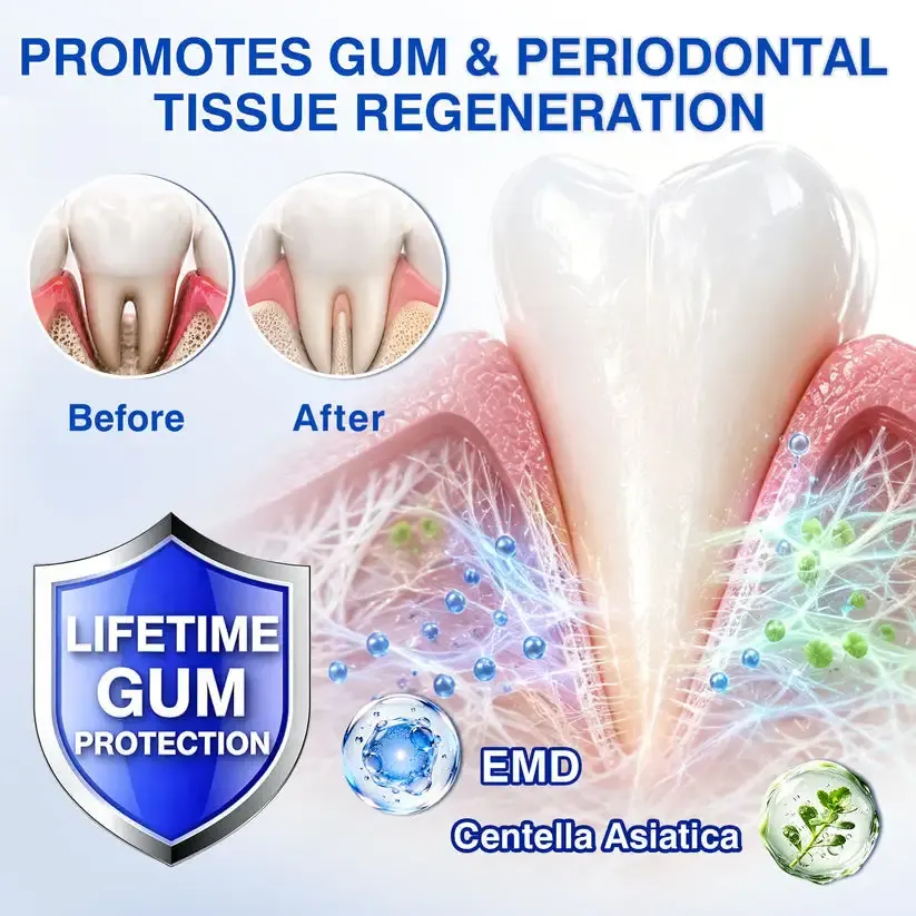 𝐆𝐮𝐦𝐑𝐞𝐯𝐢𝐯𝐞 Periodontal Repair Gel