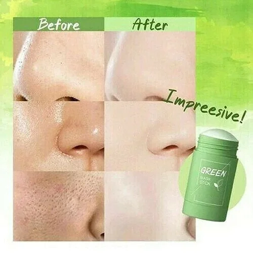 Last Day Promotion 70% OFF🔥Non-Porous Deep Cleansing Mask Pen