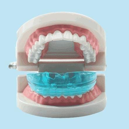 How Much Do Clear Braces Cost