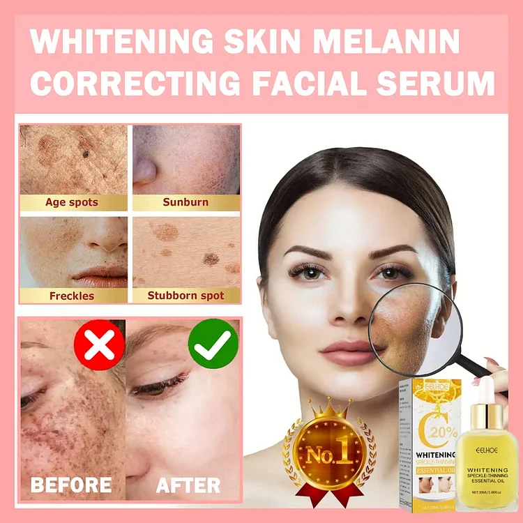 🎁2024 The Most Popular🎁 - Whitening Skin Melanin Correcting Facial Serum [Experience Flawless Skin, Starting Here!!!]