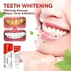🎁2025 HOT SALE🔥SP-6 Probiotic Whitening Toothpaste