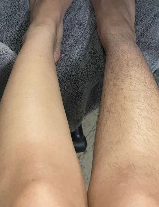 🔥BUY 1 GET 1 FREE &ndash; CRYSTAL HAIR ERASER