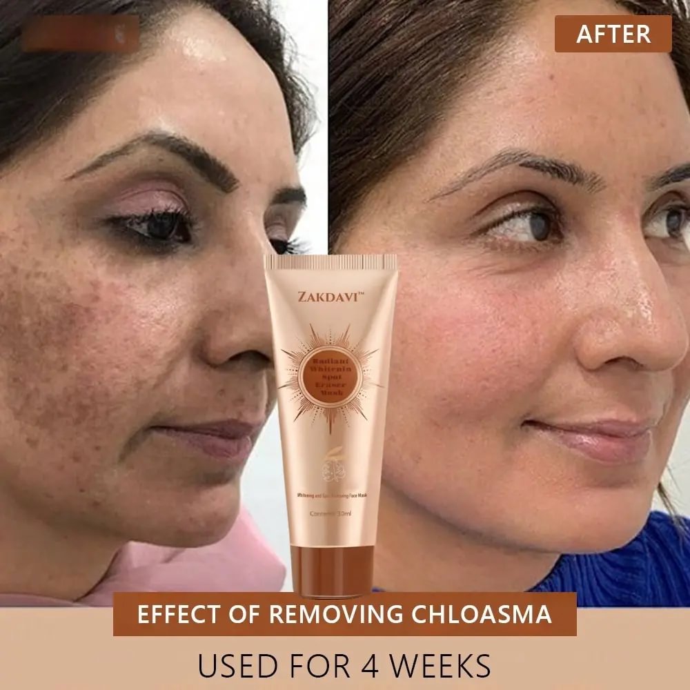 	Zakdavi&trade; Radiant Whitening & Spot Eraser Mask