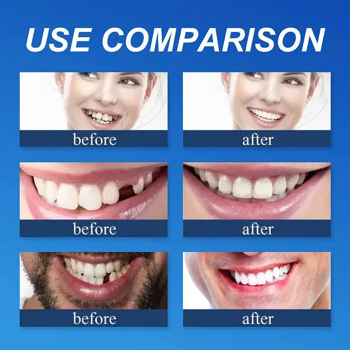 Ends Today: 70% OFF! ⏰ Medical Full Denture with Strong Suctiond🦷Obtain American Dental Association (ADA) Certification