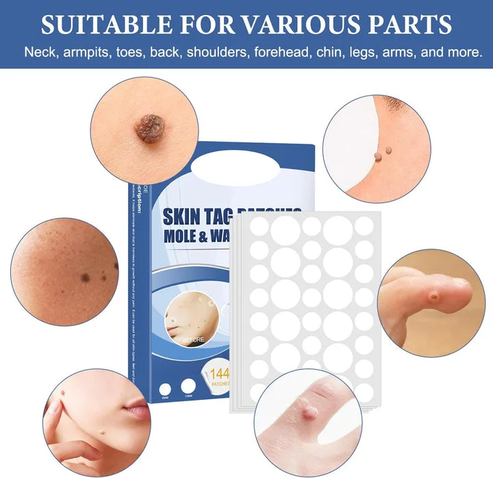 Gentle and Non-Invasive Care for Skin Tags