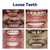 NESLEMY &ndash; 🦷Conjunto de pr&oacute;teses dent&aacute;rias avan&ccedil;adas e personalizadas🦷 (⏰Desconto por tempo limitado, com dura&ccedil;&atilde;o de 30 minutos⏰)