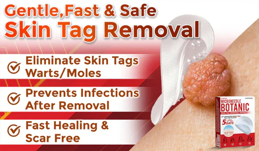 Yunpso™ MicroNeedle Botanic Skin Tag Removal Patch