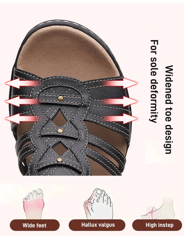 🔥Last Day Promotion 50% OFF - 2023 Casual Open Toe Orthopedic Sandals ...