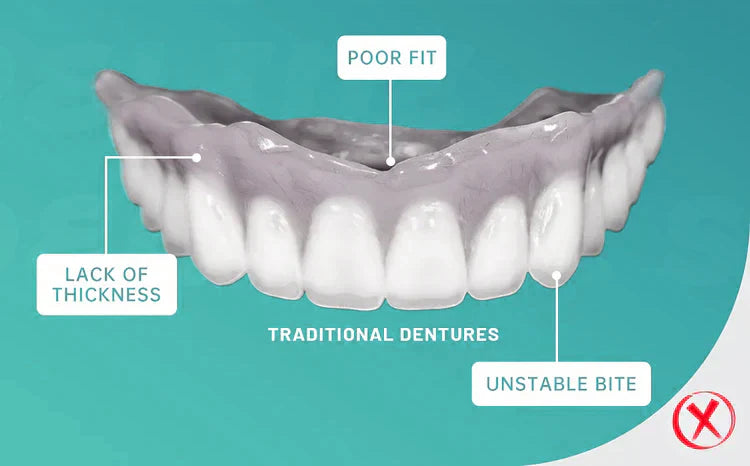 Natravor™-Advanced Custom-Fit Functional Dentures