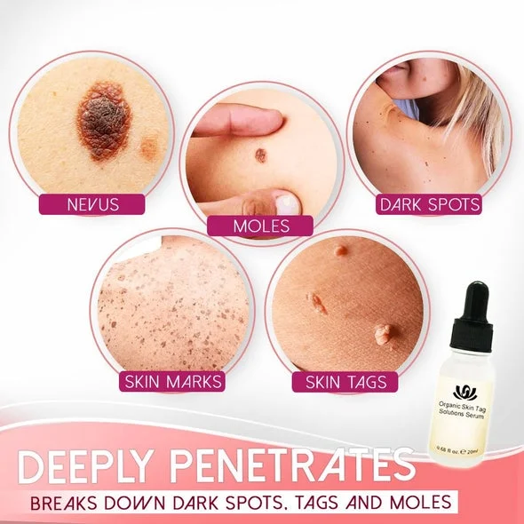 Suupillid™ Organic Skin Purifying Dark Spot Serum