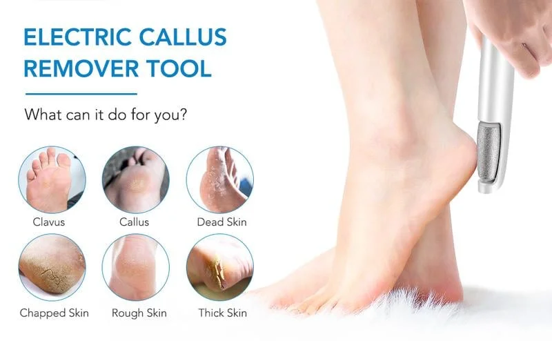 💕Mother's Day Hot Sale 49%🔥Electric Feet Callus Remover