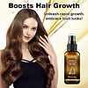 🔥Biotin Hair Growth Essence Spray (New Formula)