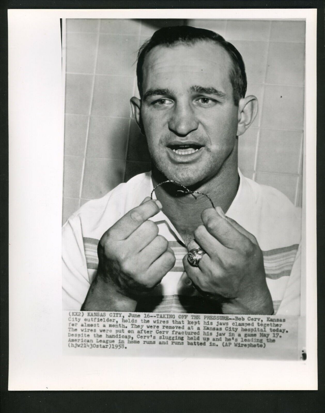 Bob Cerv with wire for fractured jaw 1958 Press Photo Poster painting Kansas City Athletics