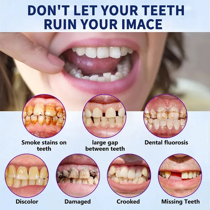 NESLEMY&trade;-🦷Advanced Customized Full Denture Set🦷 (⏰Limited time discount last 30 minutes⏰)