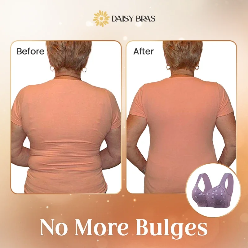 Daisy Bra &ndash; LAST DAY SALE 80% OFF &ndash; Comfortable & Convenient Front Button Bra