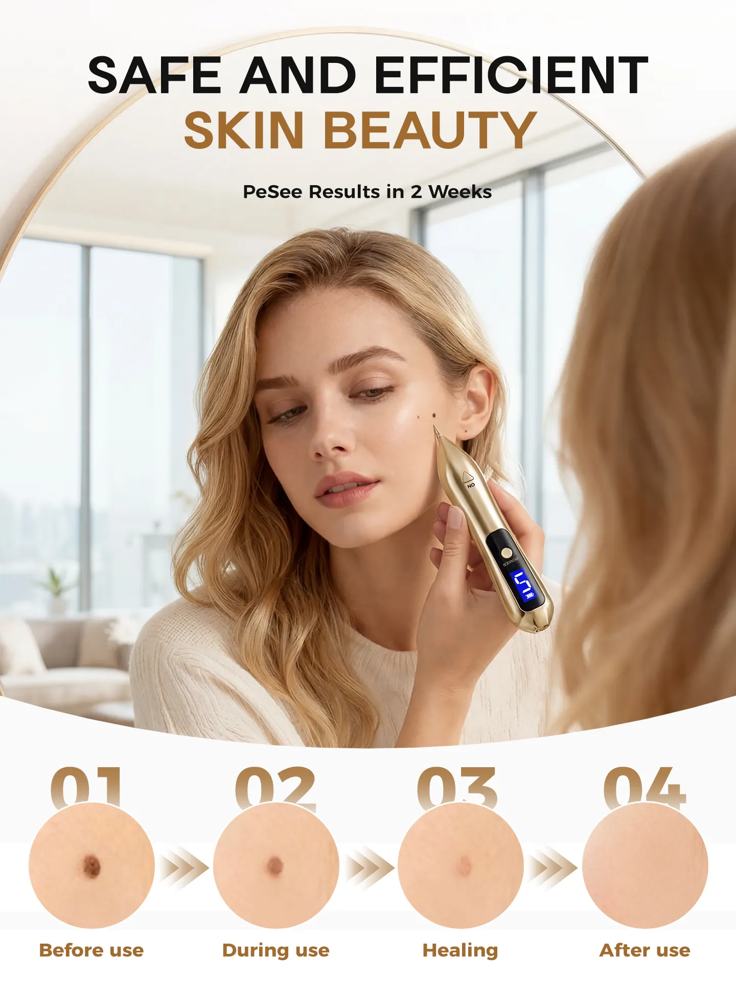 Skin Tag