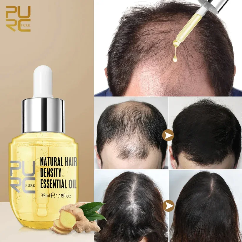 PURC™ Hair Growth Essential Oil