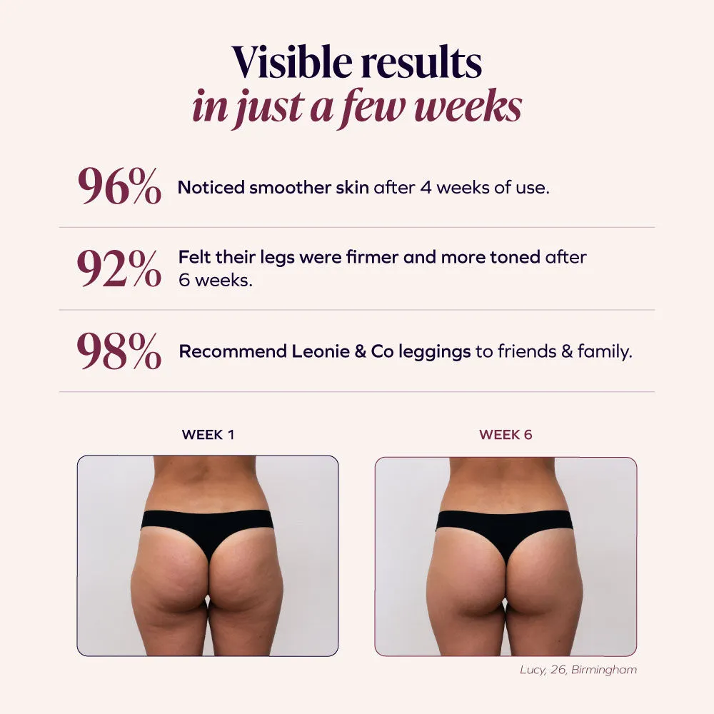 3D Shorts | &ndash; Redefine your silhouette effortlessly