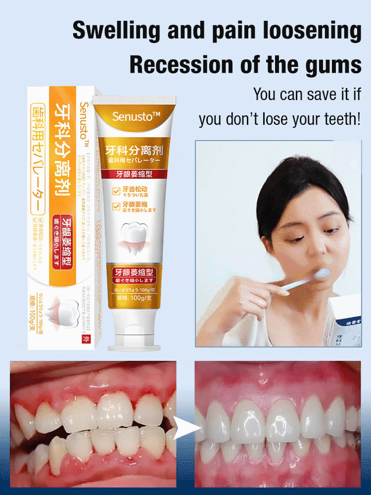 Dental Separators Dental separators