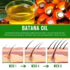 Batana Natural Hair Growth Oil