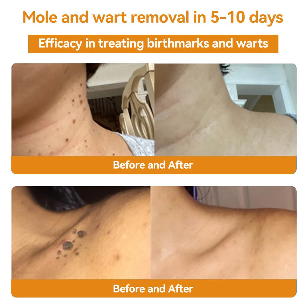 🐝𝑇𝑢𝑟𝑜𝑛𝑢 Bee Venom Skin Treatment Cream𝐴𝐴𝐷 𝑅𝑒𝑐𝑜𝑚𝑚𝑒𝑛𝑑𝑒𝑑