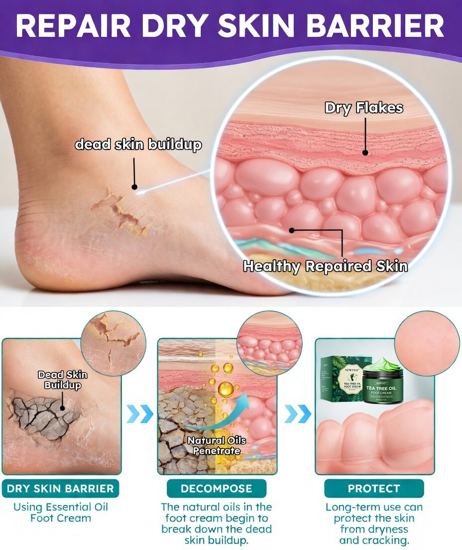 🎁 NEWYUO™ Limited-Time Offer 🎁 - Don't miss out!Tea Tree Oil Foot Cream (Repairs Dry Cracked Heels, Soothes Tired Feet, Eliminates Odor & Restores Soft Skin)
