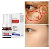 🔥Vitamin C Whitening Freckles Face Cream Remove Melasma Dark Spots Lighten Melanin