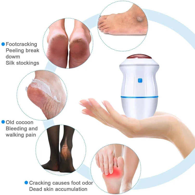 New electric dead skin foot grinder