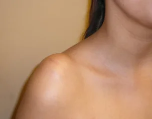 South Moon LumpFree Lipoma Removal Cream