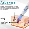 Non-Invasive Mole and Wart Removal Laser Pen