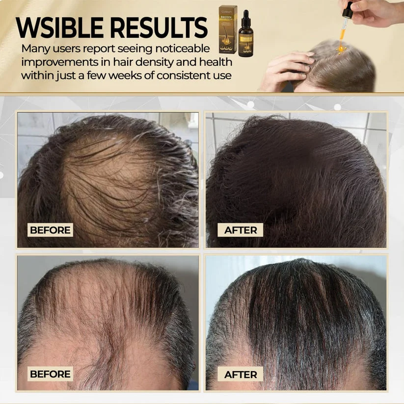 🔥HOT SALE 60% OFF🔥Biotin Hair Oil Set