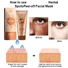 Herbal Spots Peel-Off Facial Mask
