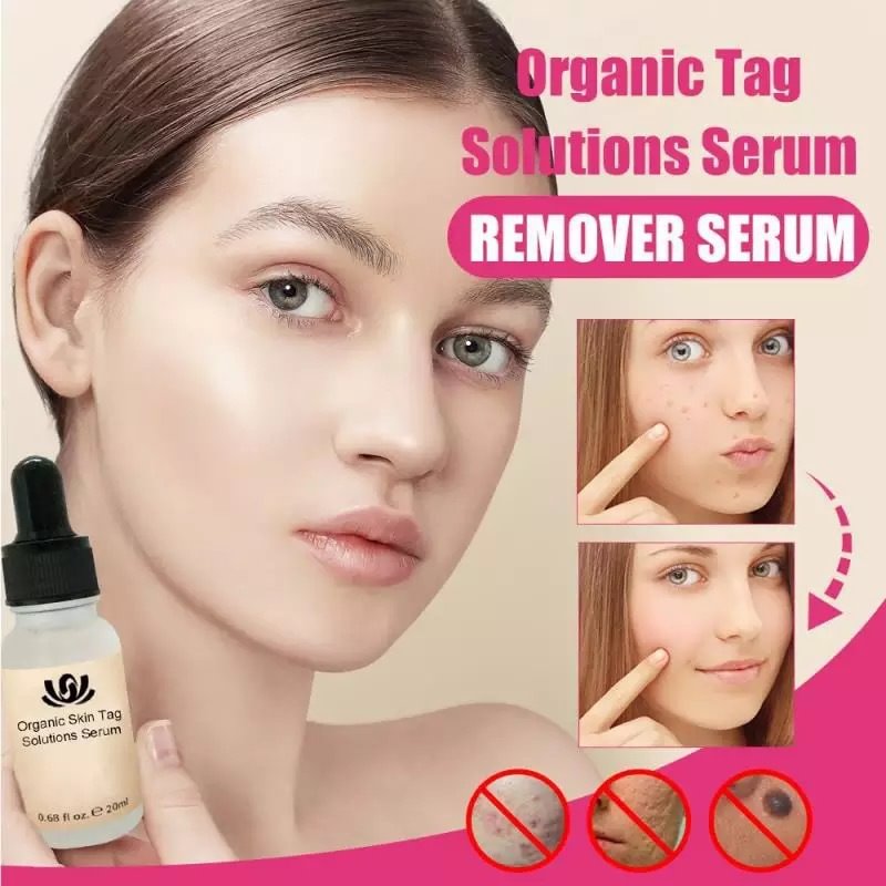 Organic Dark Spot Skin Serum