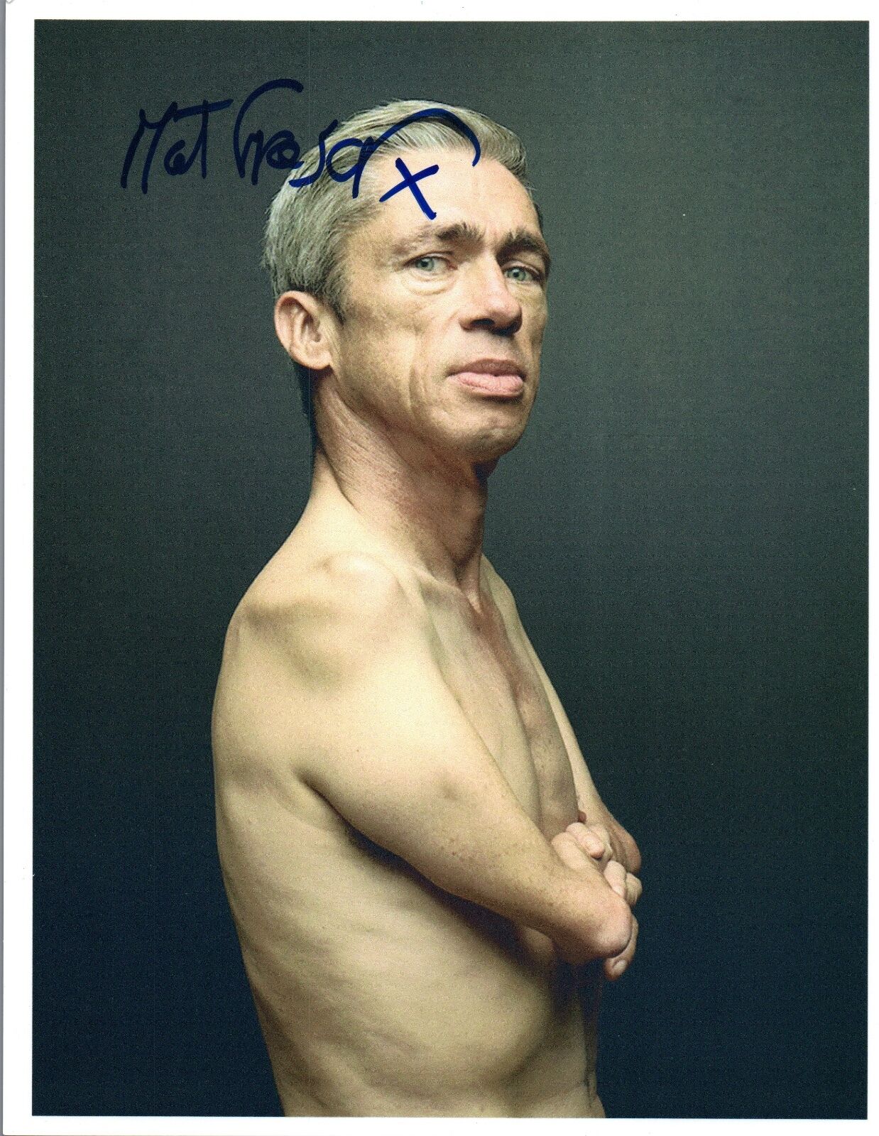 Mat Fraser Signed Autographed 8x10 Photo Poster painting American Horror Story Freak ShowCOA VD