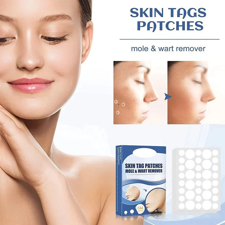 Gentle and Non-Invasive Care for Skin Tags