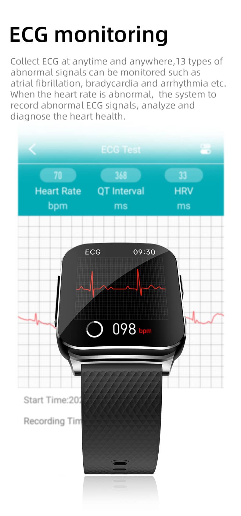 Findtime ECG Smartwatch for Blood Pressure Monitor BO&HR Blood Glucose Body Temperature