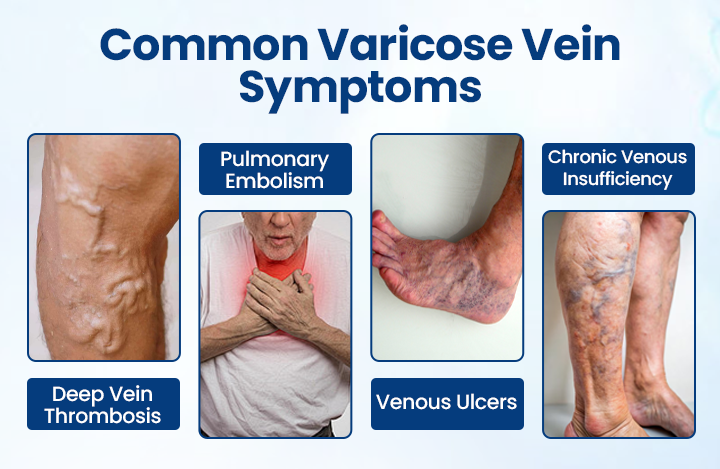 Timilk® VenoRelief Botanical Leg Spray