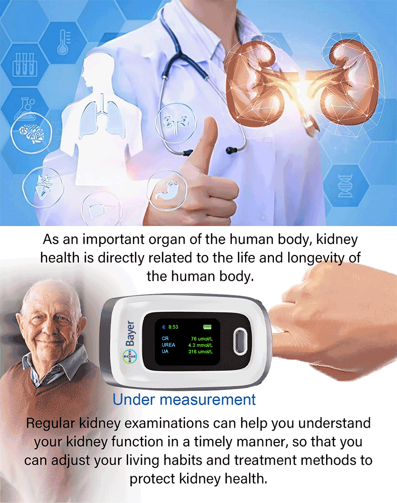 Examen de ri&ntilde;&oacute;n.gif