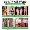 💎Ofici&aacute;ln&iacute; obchod ČR  BuildLeaf&reg; GLP-1 8-v-1 Fit & Vital Ře&scaron;en&iacute; (Jednou denně, viditeln&eacute; změny za 7 dn&iacute;) Obezita, kardiovaskul&aacute;rni zdrav&iacute;, cukrovka, sp&aacute;nkov&aacute; apnoe, zdrav&iacute; střev, probl&eacute;my se klouby a dal&scaron;&iacute;.