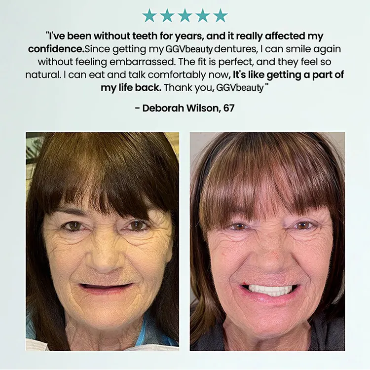 🦷  Fit Full Functional DenturesMake you more confident