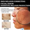 Melanin correction facial serum for fast dark spot removal