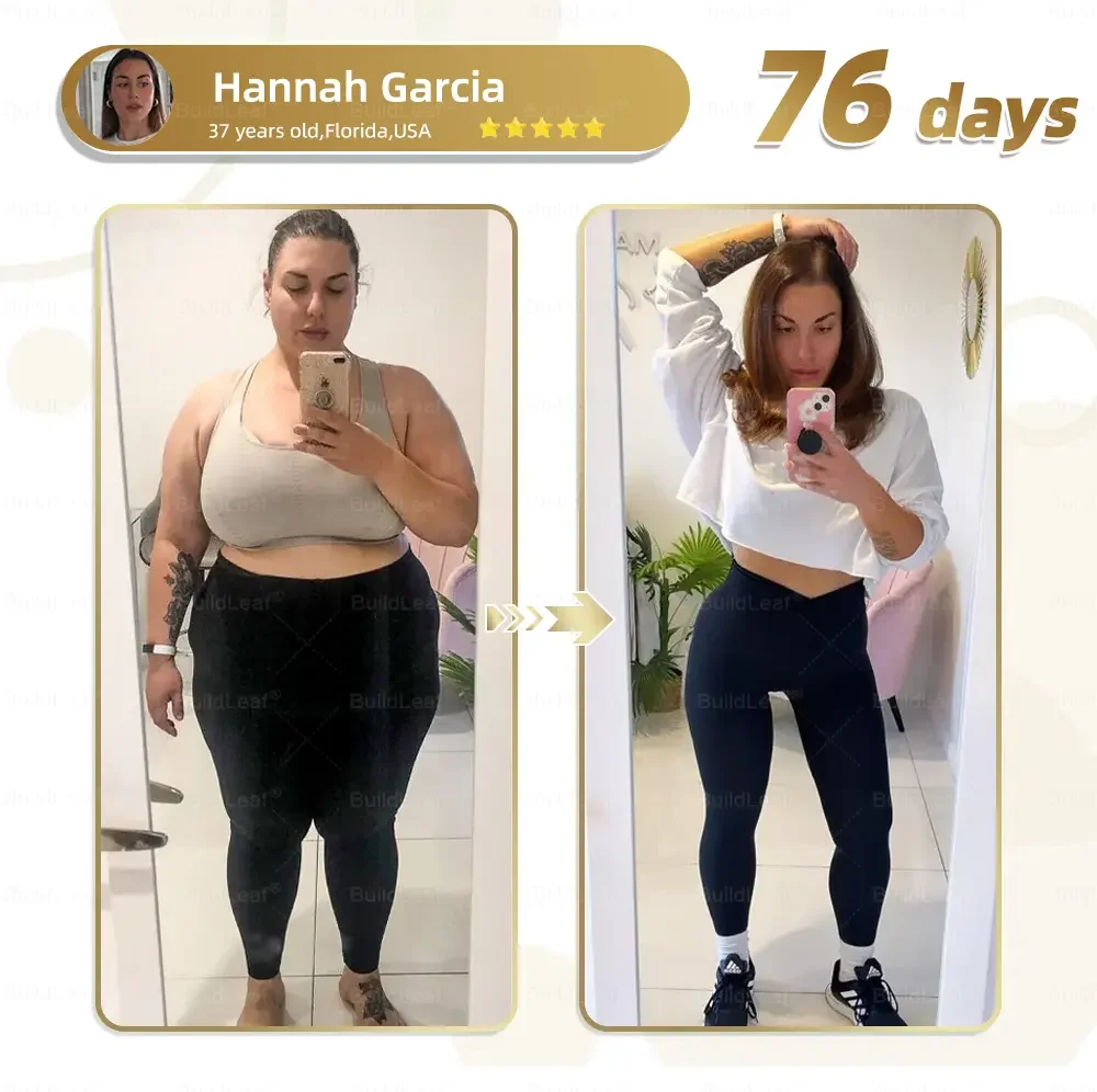 	BuildLeaf&reg; NIDDK-Tirzepatide Slimming & health NANO MICRONEEDLE PATCH